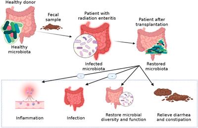 Pathogenesis and therapy of <mark class="highlighted">radiation enteritis</mark> with gut microbiota